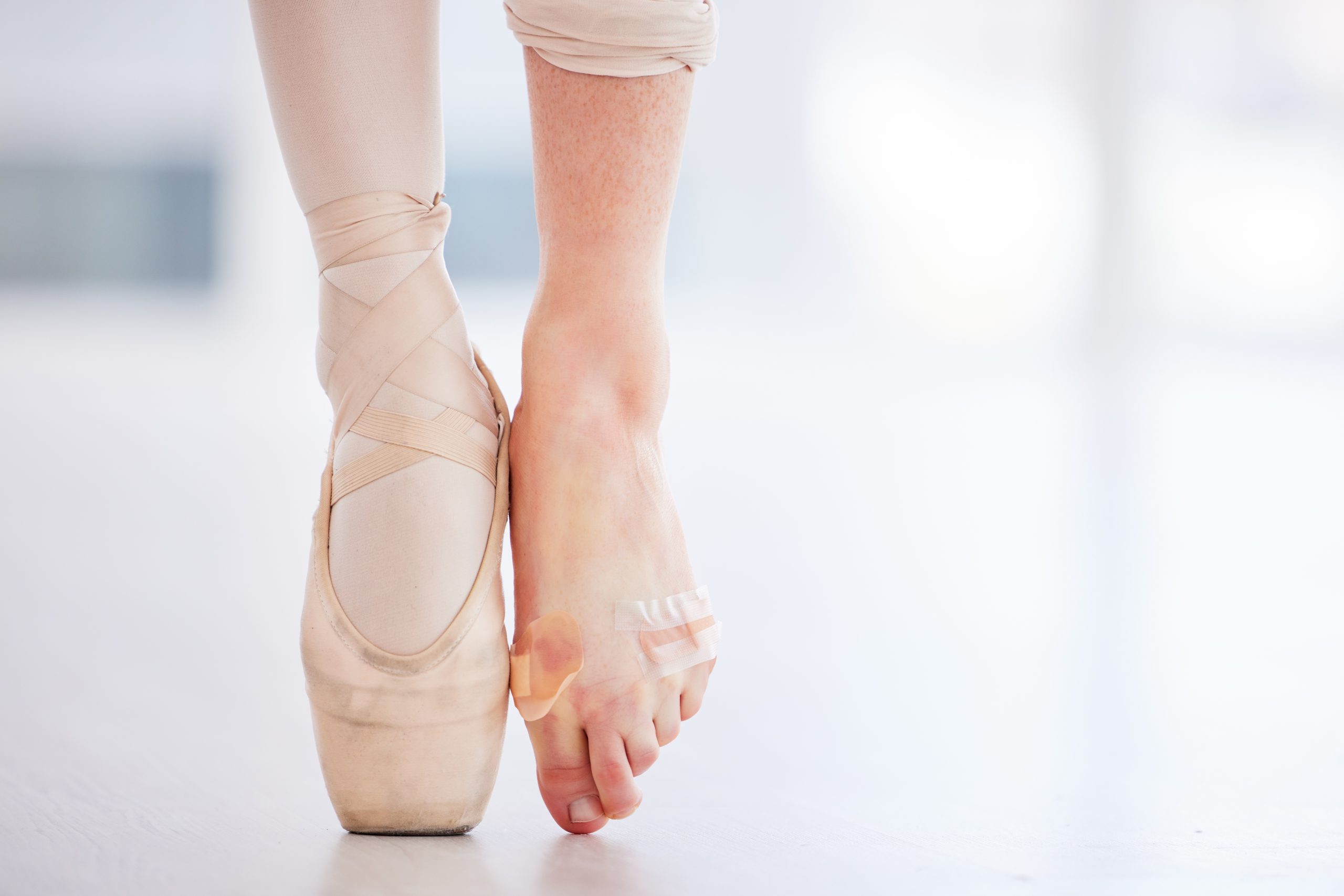The ballet blog - Stress Fracture: understanding bone stress injury Part 1  - cssm